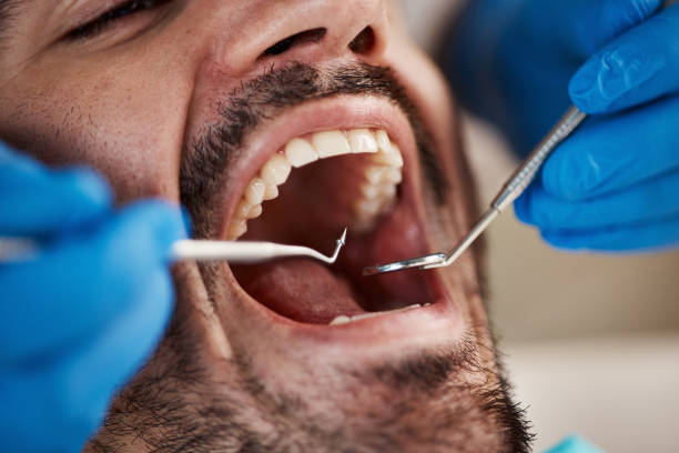 Best Broken or Cracked Tooth Emergency Dentist in Necedah, WI