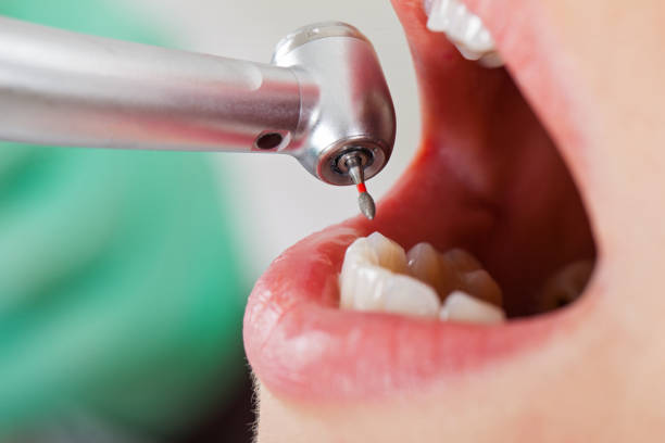 Best Emergency Dentist for Knocked-Out Tooth in Necedah, WI